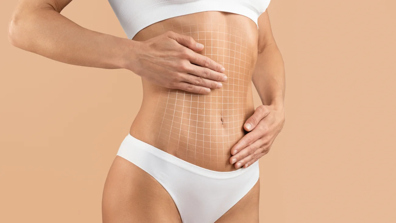 Tummy Tuck. Cropped Of Female Body With Flat Abdomen And Drawn Mesh